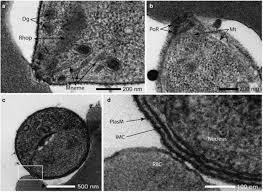 Attēlu rezultāti vaicājumam “Enteridium variabile plasmodium”