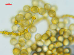 Attēlu rezultāti vaicājumam “Stemonitopsis hyperopta var. landewaldii spores”