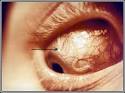 Is there really a <b>parasite</b>