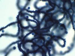 Attēlu rezultāti vaicājumam “Heterotrichia obvelata (syn. Arcyria obvelata) spores”