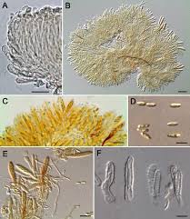 Attēlu rezultāti vaicājumam “Hyphodiscus hymeniophilus”