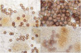 Attēlu rezultāti vaicājumam “Diderma rufostriatum”