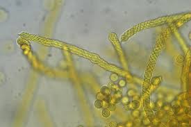 Attēlu rezultāti vaicājumam “Trichia scabra spores”