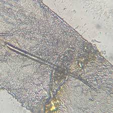 Attēlu rezultāti vaicājumam “Pilobolus crystallinus”