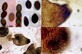 Attēlu rezultāti vaicājumam “Sordaria fimicola”