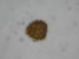 Attēlu rezultāti vaicājumam “Fossombronia foveolata spores”