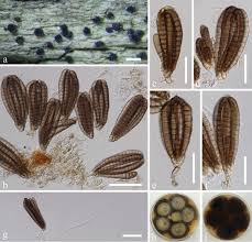 Attēlu rezultāti vaicājumam “Didymium spongiosum var. dictyospora spores”