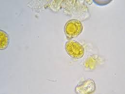 Attēlu rezultāti vaicājumam “Puccinia sessilis”