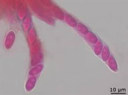 Attēlu rezultāti vaicājumam “Neonectria fuckeliana”