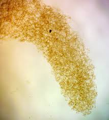 Attēlu rezultāti vaicājumam “Heterotrichia oerstedii (syn. Arcyria oerstedii) sessile”