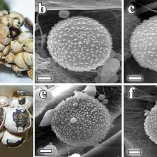 Attēlu rezultāti vaicājumam “Hemitrichia leiotricha spores”