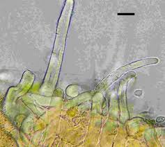 Attēlu rezultāti vaicājumam “Octosporella jungermanniarum”