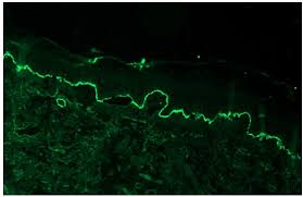 Attēlu rezultāti vaicājumam “Pemphigus borealis”