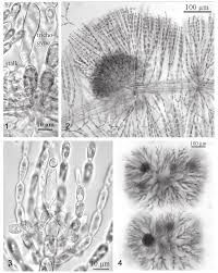 Attēlu rezultāti vaicājumam “Batrachospermum moniliforme”