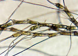 Attēlu rezultāti vaicājumam “Bulbochaete mirabilis”