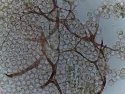 Attēlu rezultāti vaicājumam “Stemonitopsis amoena spores”