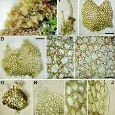 Attēlu rezultāti vaicājumam “Leiocolea collaris”