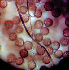 Attēlu rezultāti vaicājumam “Diderma umbilicatum macro”