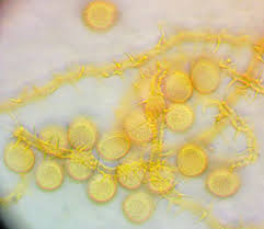 Attēlu rezultāti vaicājumam “Ophiotheca sp.”