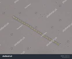 Attēlu rezultāti vaicājumam “Nostoc commune cells”