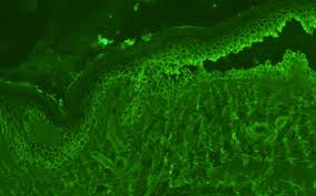 Attēlu rezultāti vaicājumam “Pemphigus borealis”