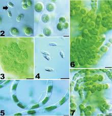 Attēlu rezultāti vaicājumam “Gloeocapsa rupestris”