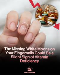 Image result for lunula nail