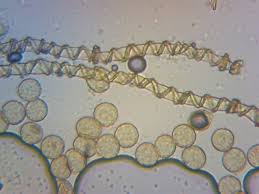 Attēlu rezultāti vaicājumam “Hemitrichia clavata spores”