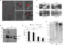 Attēlu rezultāti vaicājumam “Enteridium variabile plasmodium”