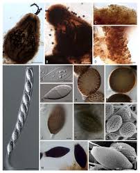 Attēlu rezultāti vaicājumam “Lasiosphaeria ovina spores”