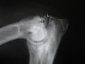 Elbow dysplasia