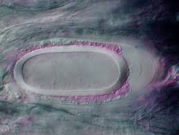 Attēlu rezultāti vaicājumam “Mycoblastus sanguinarius”