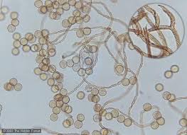 Attēlu rezultāti vaicājumam “Comatricha elegans var. microspora spores”