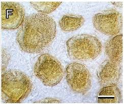 Attēlu rezultāti vaicājumam “Lycogala miserum”