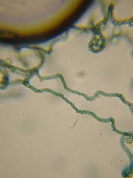 Attēlu rezultāti vaicājumam “Arcyria cinerea spores”