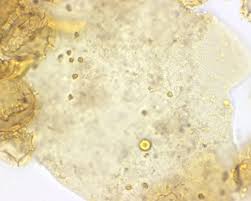 Attēlu rezultāti vaicājumam “Comatricha ellae spores”