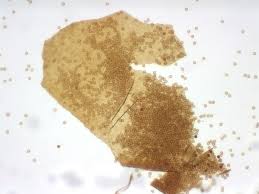 Attēlu rezultāti vaicājumam “Oligonema sp.”