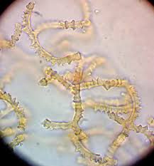 Attēlu rezultāti vaicājumam “Arcyria, Heterotrichia sp.”