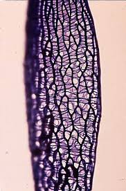 Attēlu rezultāti vaicājumam “Sphagnum sporophyte”