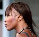 ... Bald NAomi Campell Hair Loss Side Picture - Bald-Naomi-Campbell-Hair-Loss