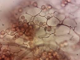 Attēlu rezultāti vaicājumam “Stemonitis pallida”