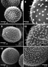 Attēlu rezultāti vaicājumam “Lamproderma ovoideum spores”