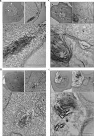 Attēlu rezultāti vaicājumam “Diderma radiatum plasmodium”