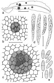 Attēlu rezultāti vaicājumam “Metzgeria furcata”