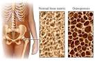 occur in <b>post menopausal</b>