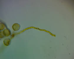 Attēlu rezultāti vaicājumam “Trichia contorta”