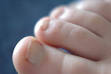 Toe - Wikipedia, the free encyclopedia