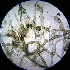 Attēlu rezultāti vaicājumam “Ascomycota”