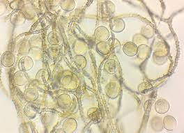 Attēlu rezultāti vaicājumam “Gulielmina vermicularis”