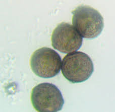 Attēlu rezultāti vaicājumam “Licea pusilla macro”